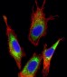 Transferrin Antibody